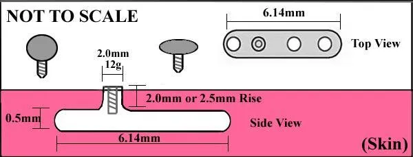 12g Steel Dermal Anchor with 2mm or 2.5mm Rise and 3-Hole Base — Price Per 1